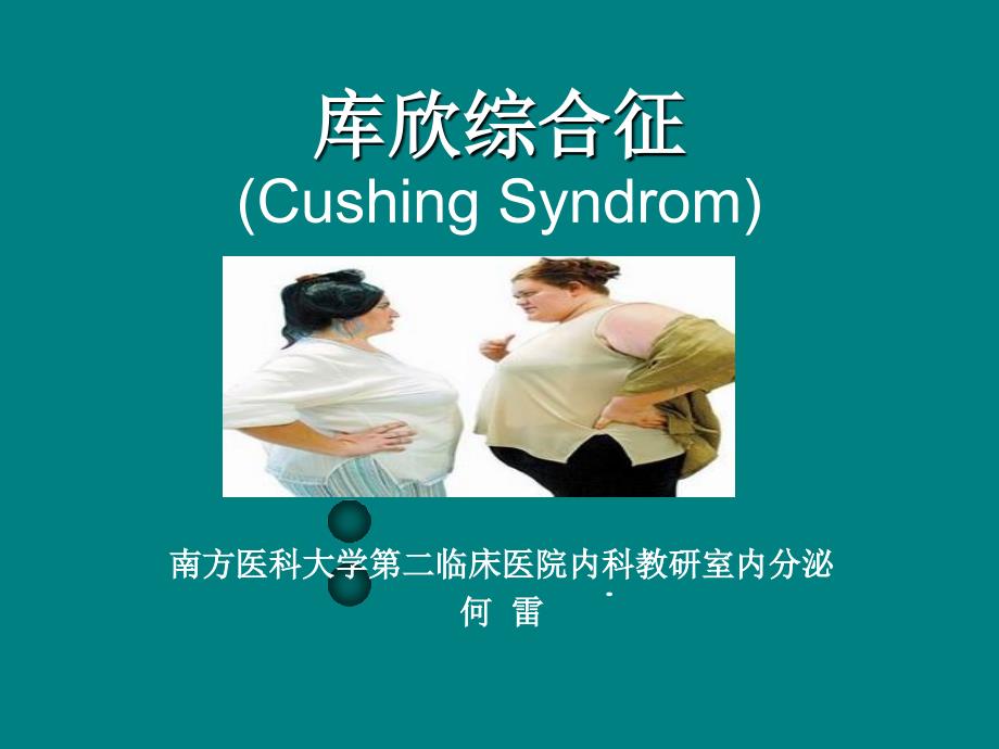 库欣综合征.ppt_第1页
