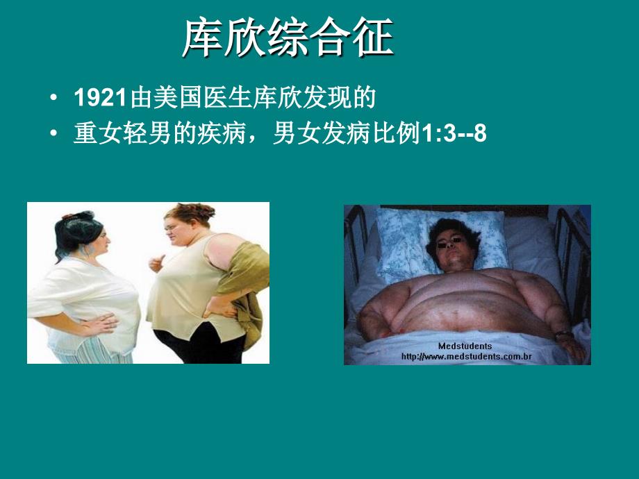 库欣综合征.ppt_第2页