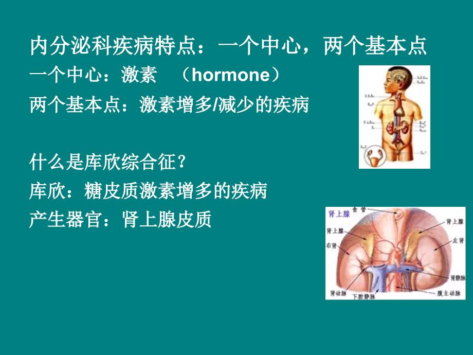 库欣综合征.ppt_第3页