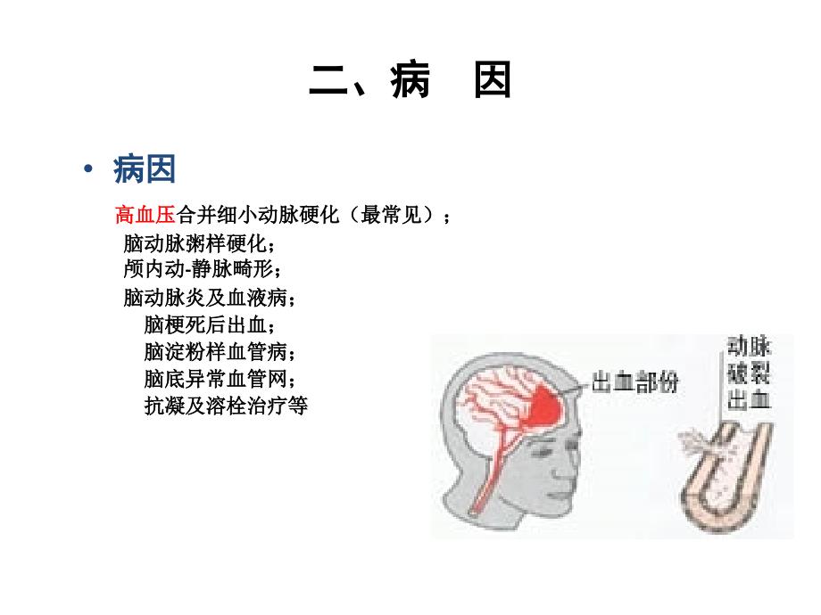 脑出血护理PPT课件.ppt_第3页