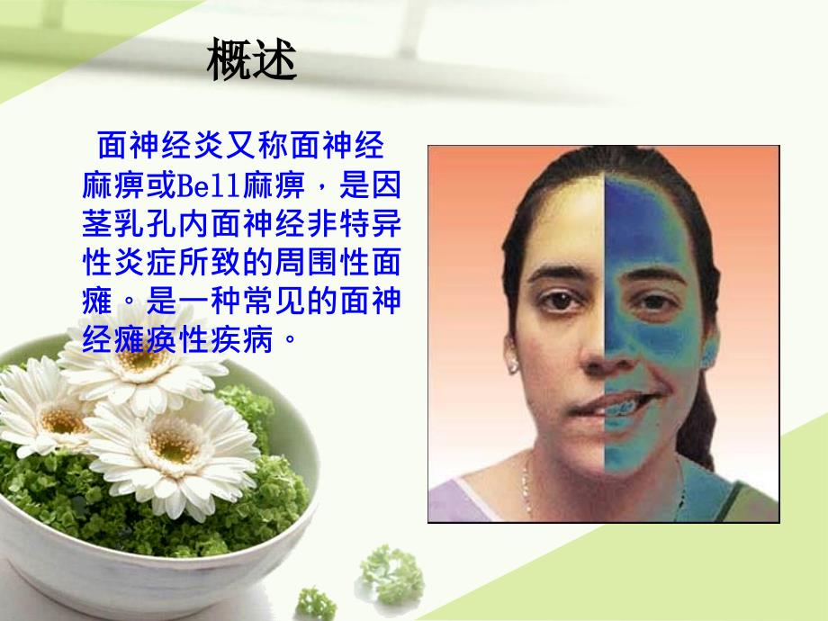 面神经炎的护理2ppt课件.ppt_第3页