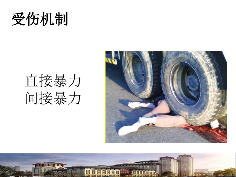 股骨干骨折骨折PPT课件.ppt_第3页