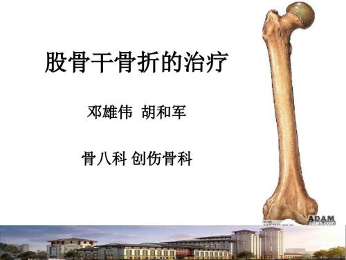 股骨干骨折骨折PPT课件.ppt