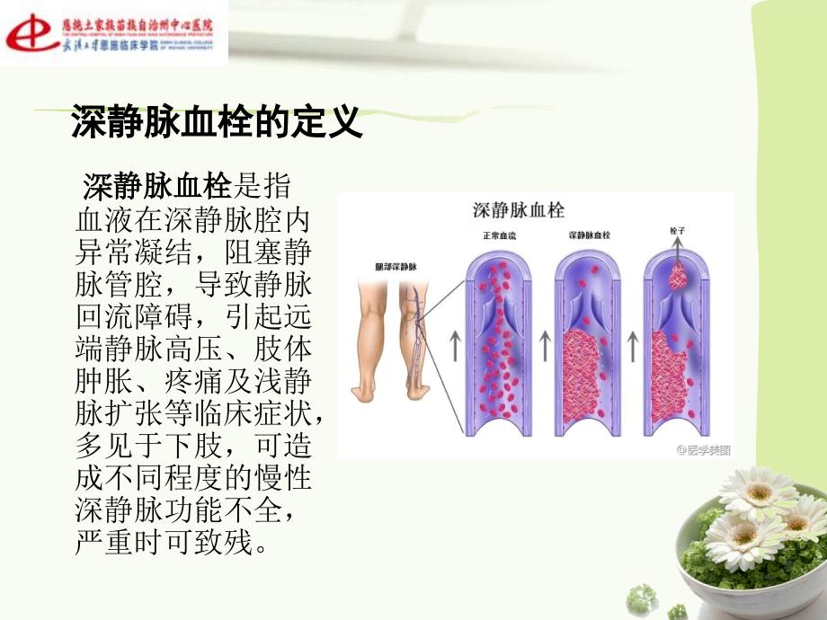 运用PDCA管理降低深静脉血栓的发生率.ppt_第2页