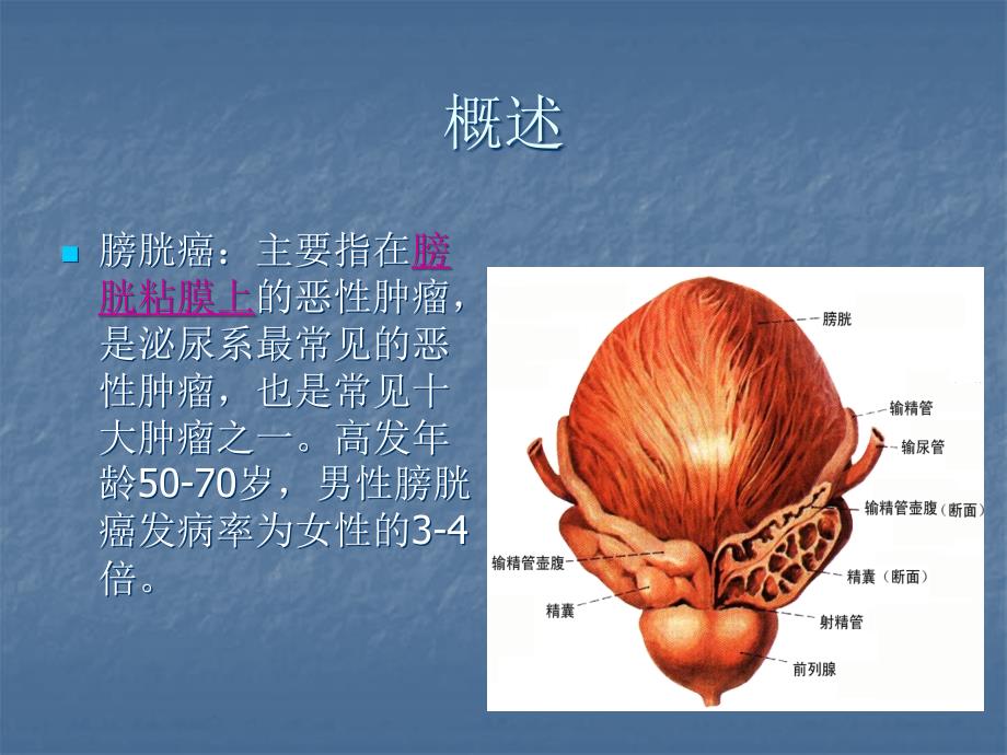 膀胱癌护理查房PPT.ppt_第3页