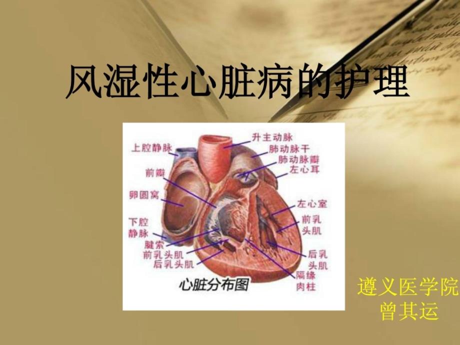 风湿性心脏病的护理.ppt_第1页