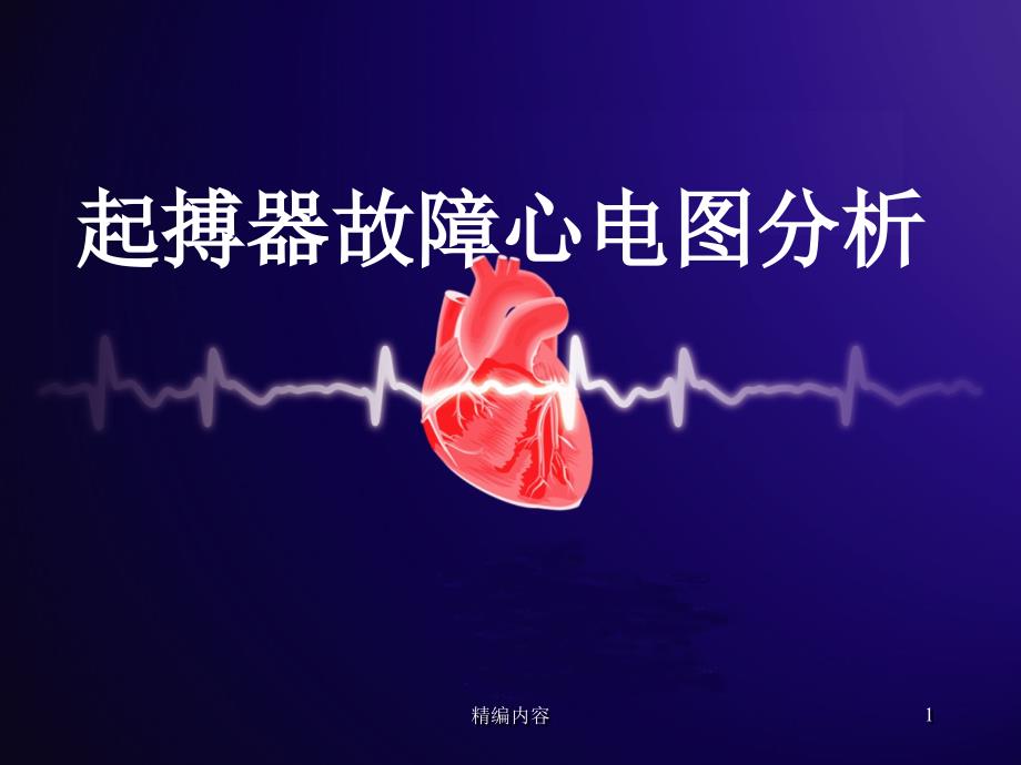 起搏器故障心电图分析深度分析.ppt_第1页