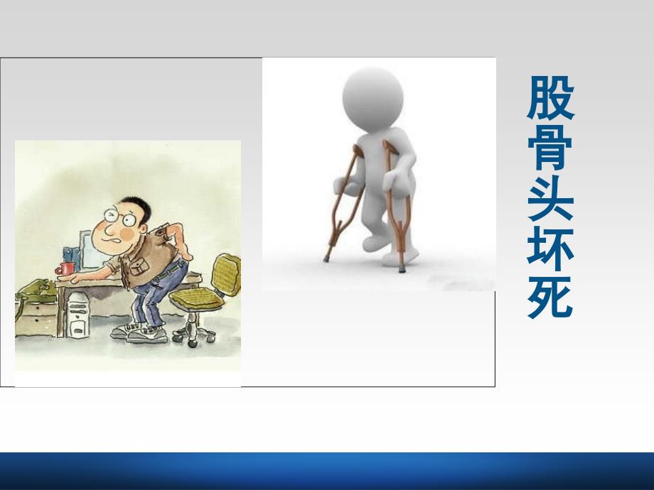股骨头坏死PPT课件.ppt_第2页