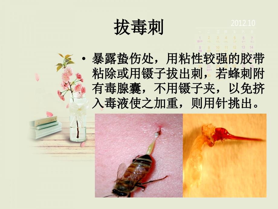 蜂蛰伤的急救课件.ppt_第3页
