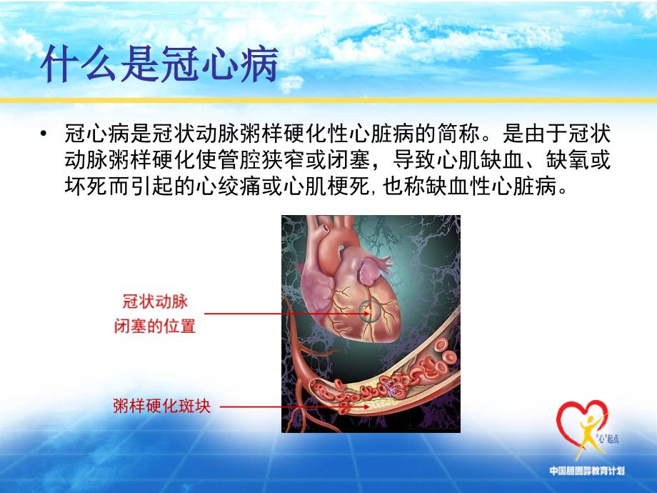 预防心梗发生PPT课件.ppt_第2页