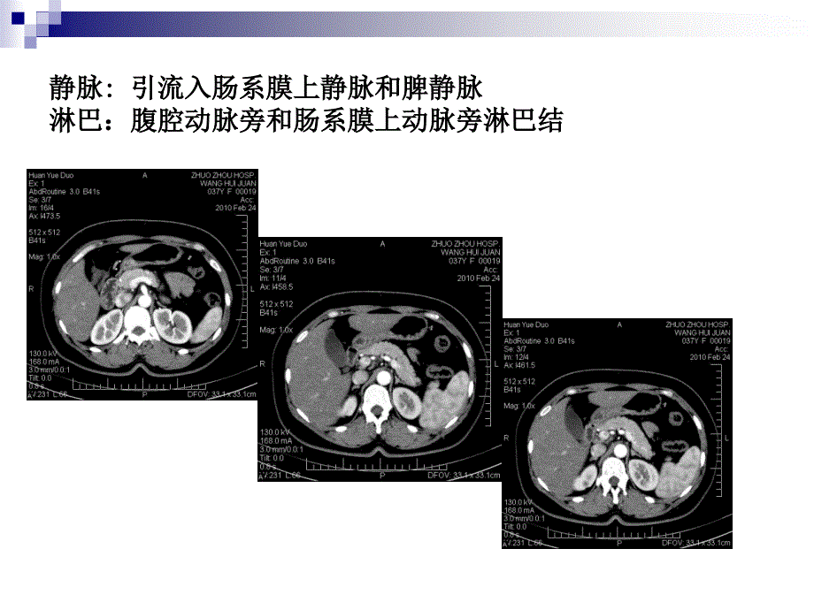 胰腺癌综合诊治中国专家共识.ppt_第2页