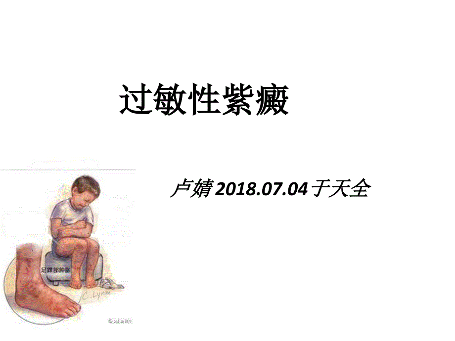 过敏性紫癜课件.ppt_第1页