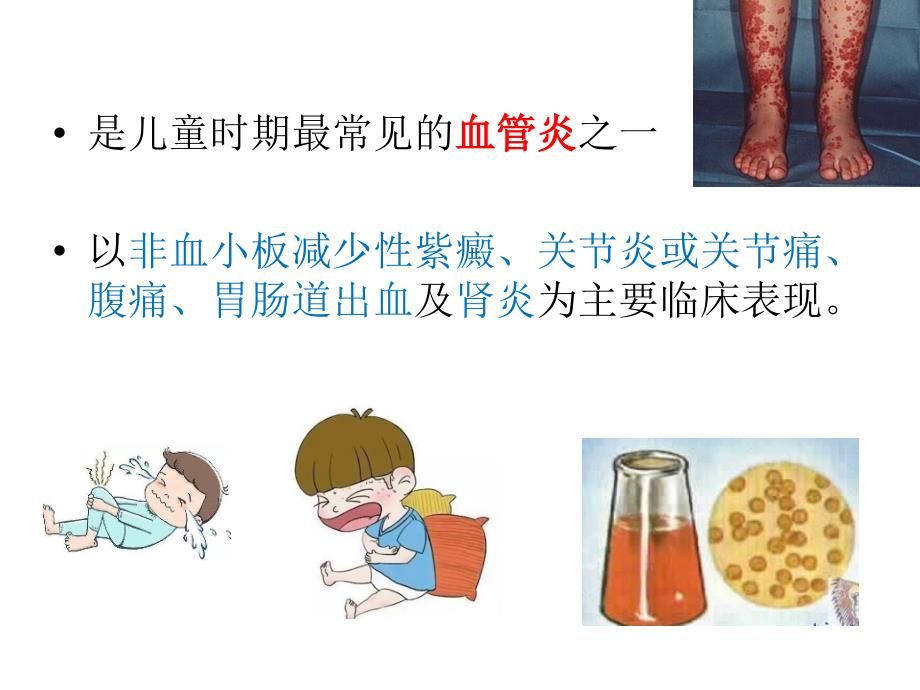 过敏性紫癜课件.ppt_第2页