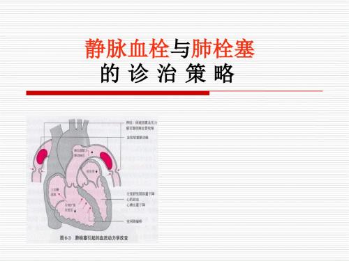 静脉血栓与肺血栓PPT课件.pptx