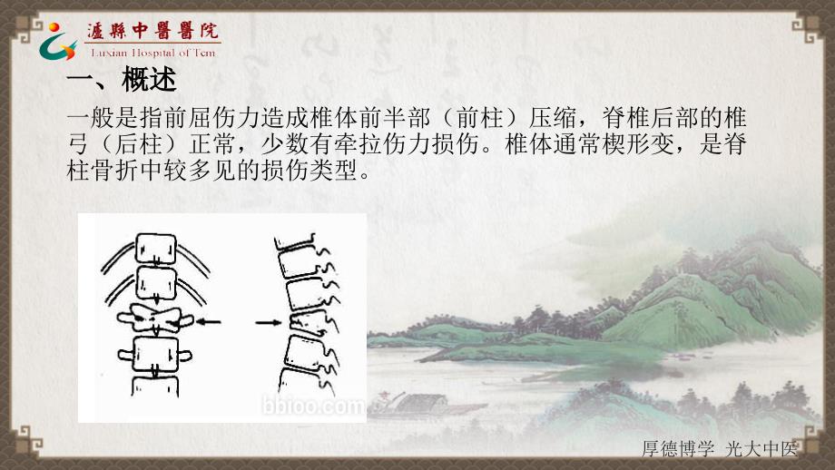 腰椎压缩性骨折病人的护理.ppt_第3页