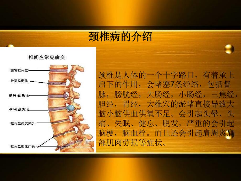 风湿骨病ppt课件.ppt_第2页