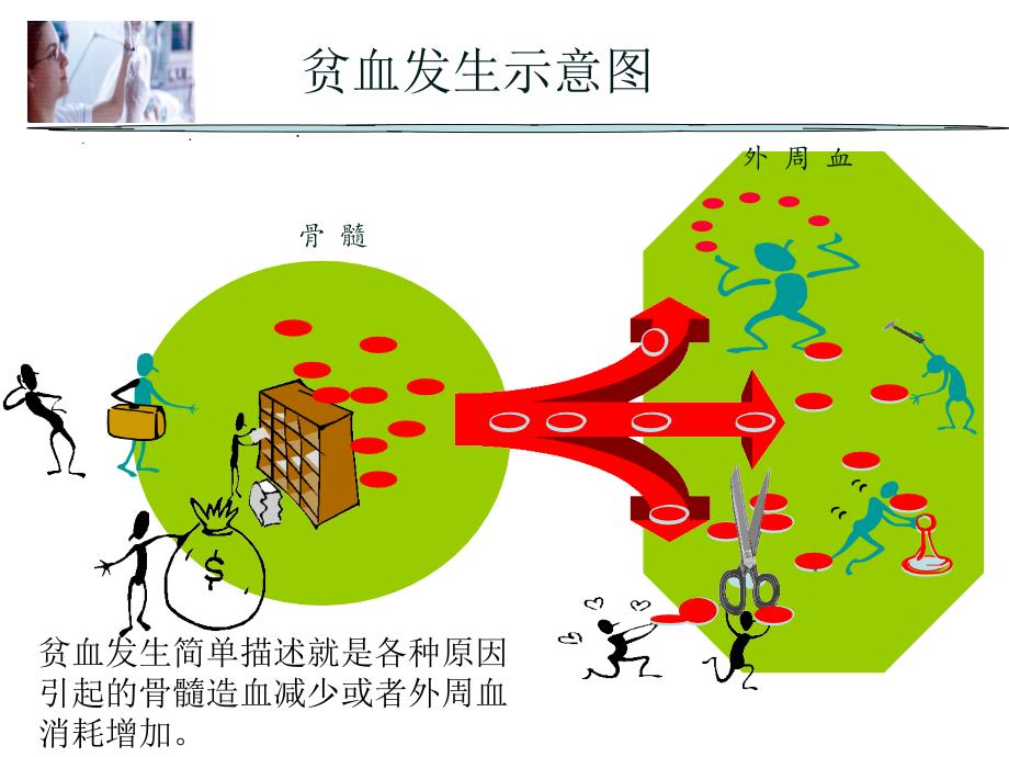 贫血概述ppt课件.ppt_第2页