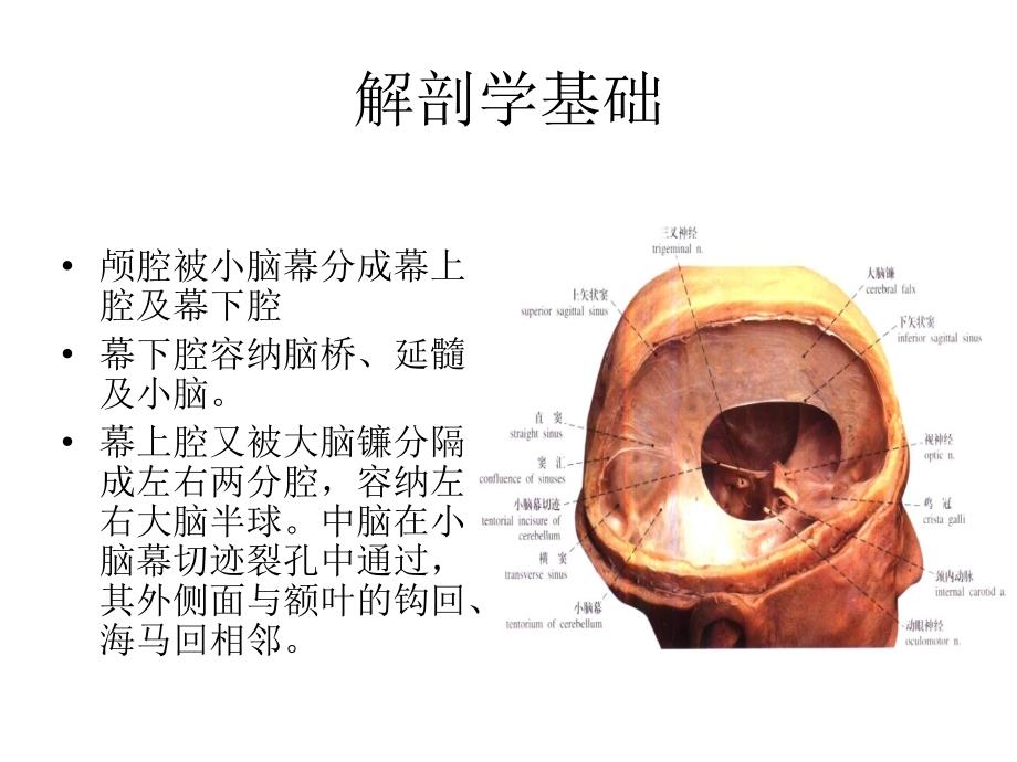 脑疝课件.ppt_第2页