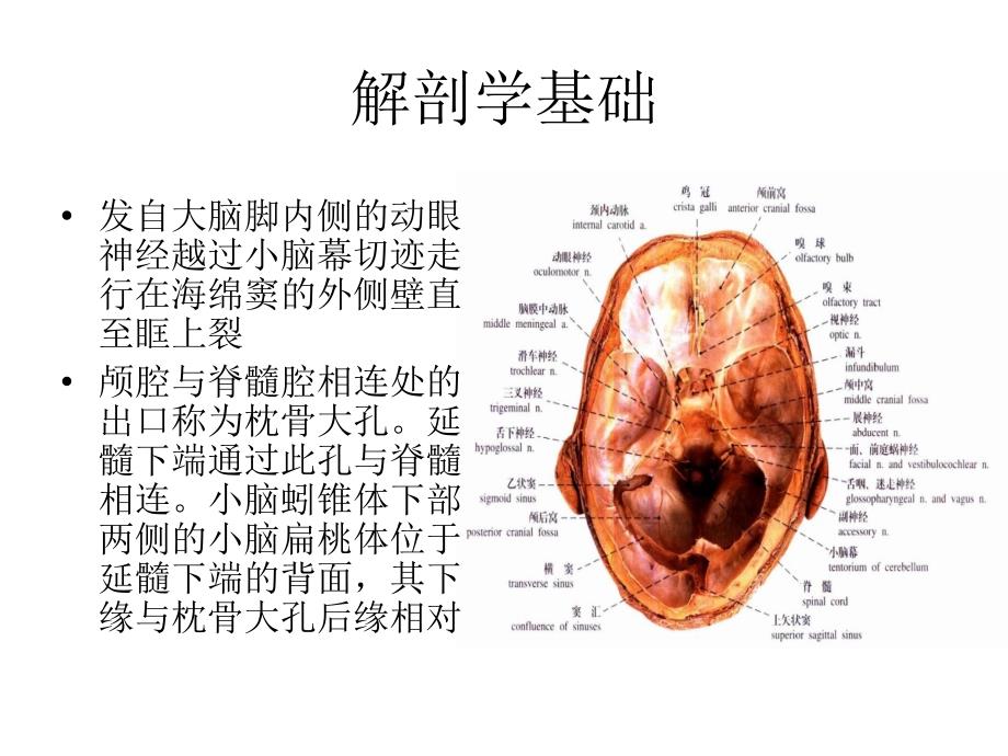 脑疝课件.ppt_第3页