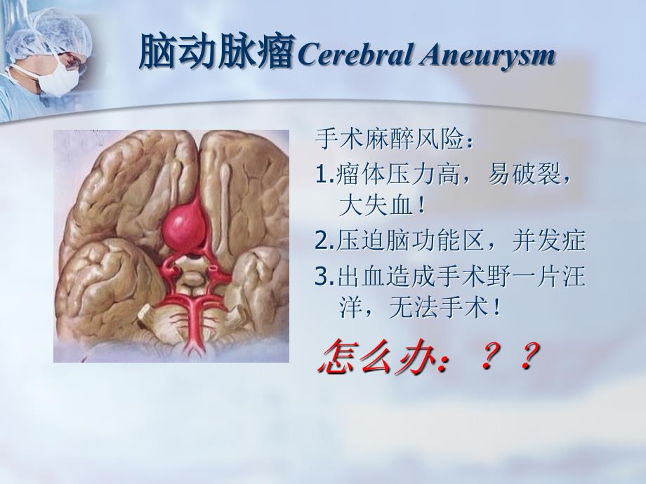 麻醉科内讲课控制性降压.ppt_第2页