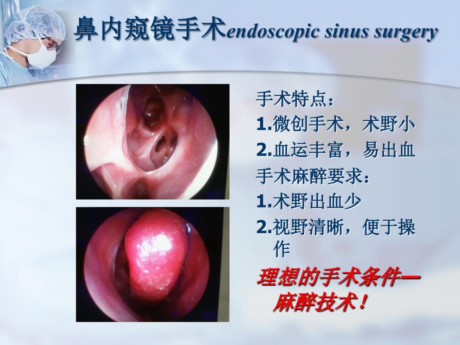 麻醉科内讲课控制性降压.ppt_第3页