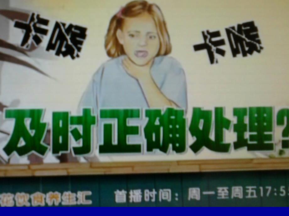食物异物卡喉急救.ppt_第2页