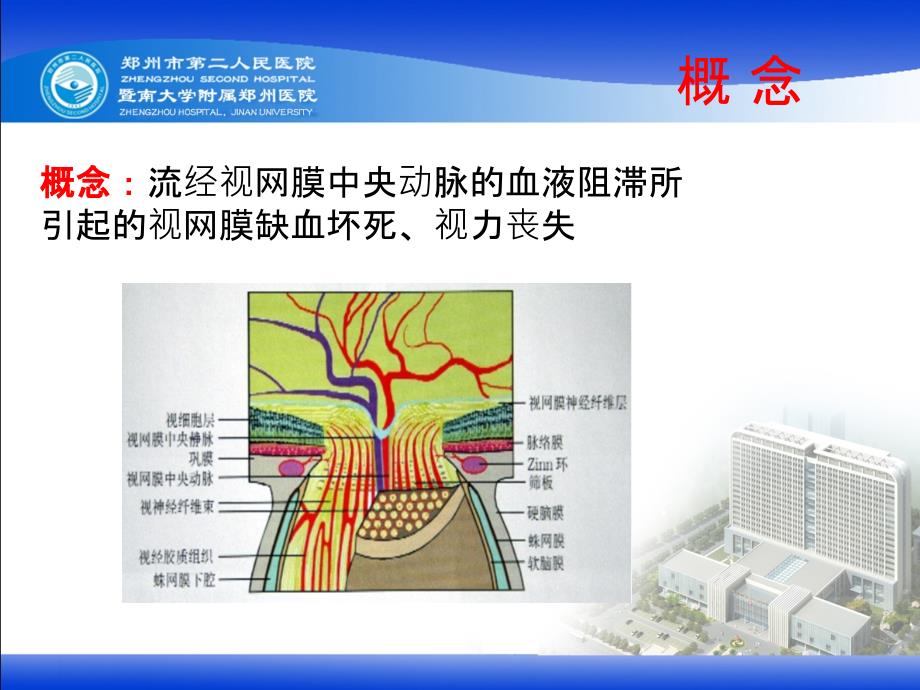 视网膜中央动脉阻塞课件.ppt_第2页