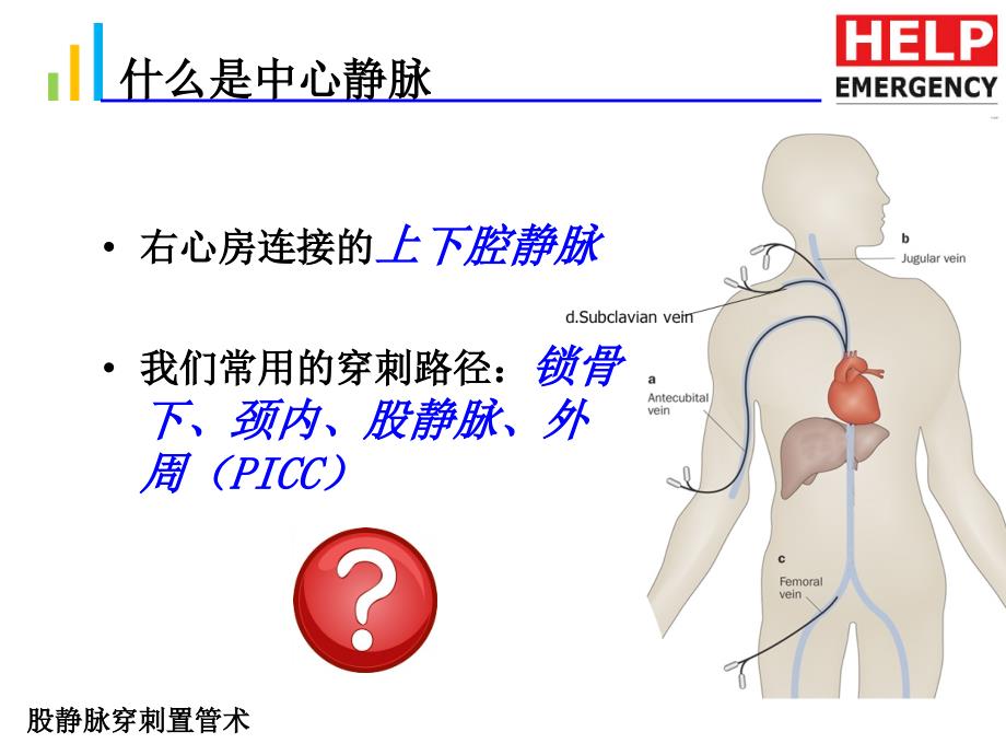 股静脉置管术PPT课件.ppt_第2页