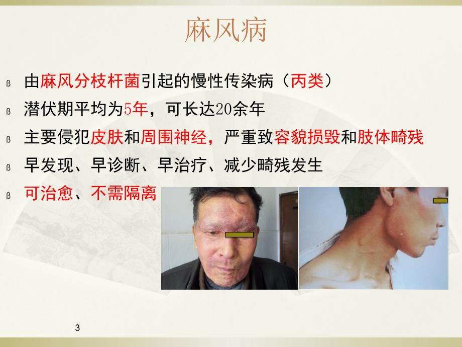 麻风病流行现状和防治概况.ppt_第3页