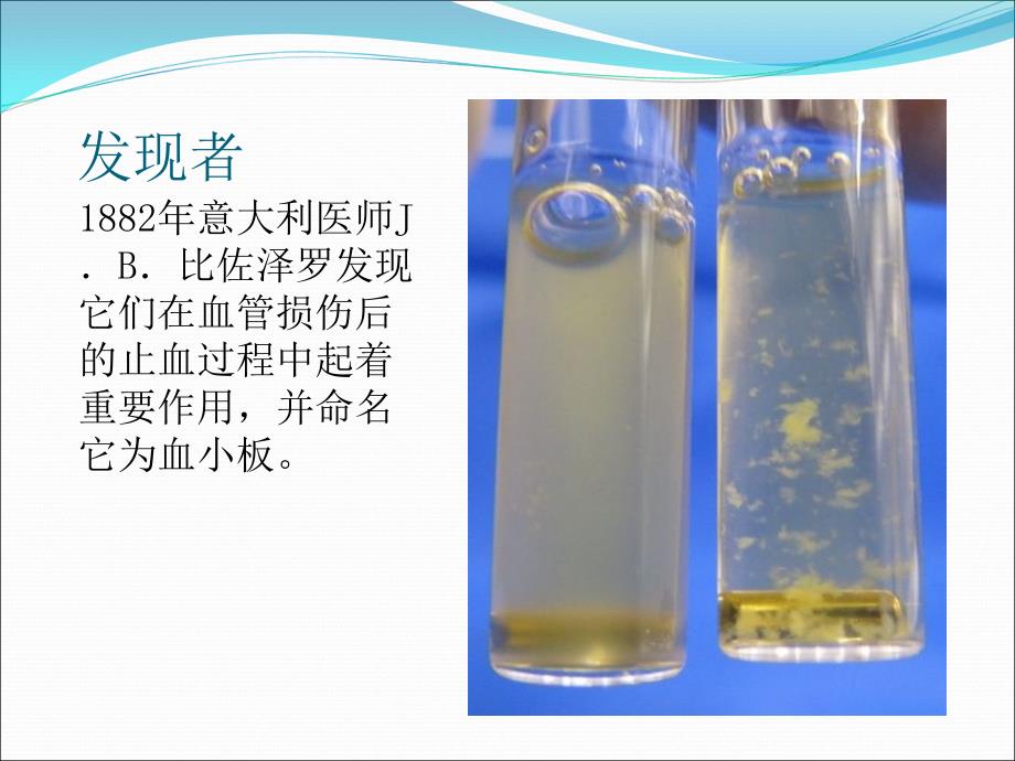 血小板减少症PPT课件.ppt_第3页