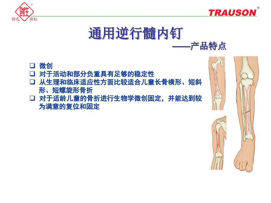 通用逆行髓内钉小儿弹性髓内钉.ppt.ppt_第2页