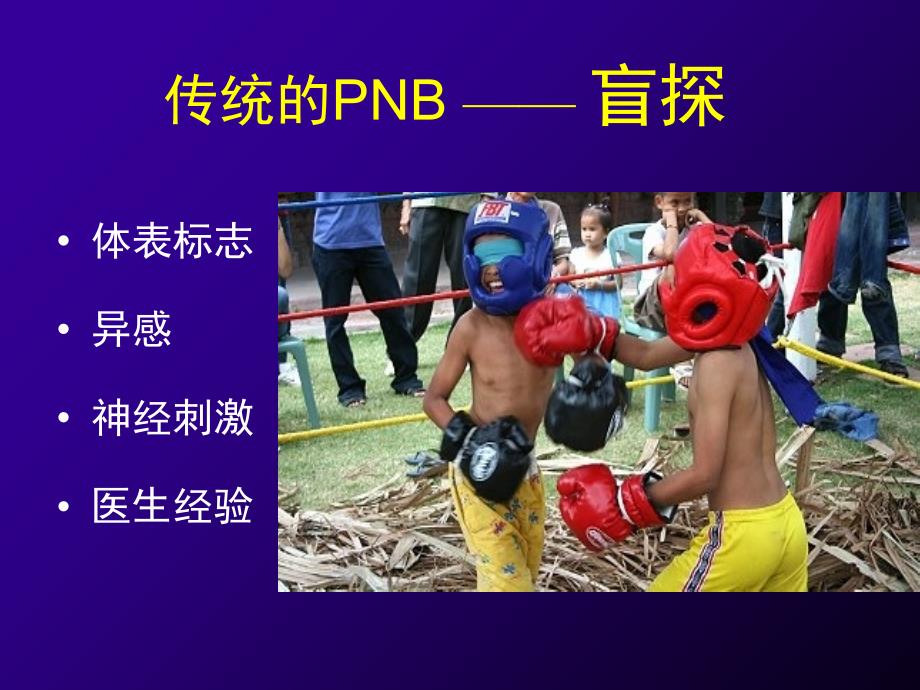 超声引导神经阻滞PPT.ppt_第2页