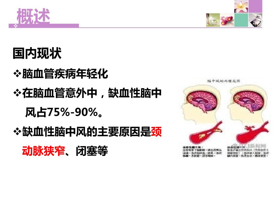 颈动脉内膜剥脱术护理ppt课件.ppt_第3页