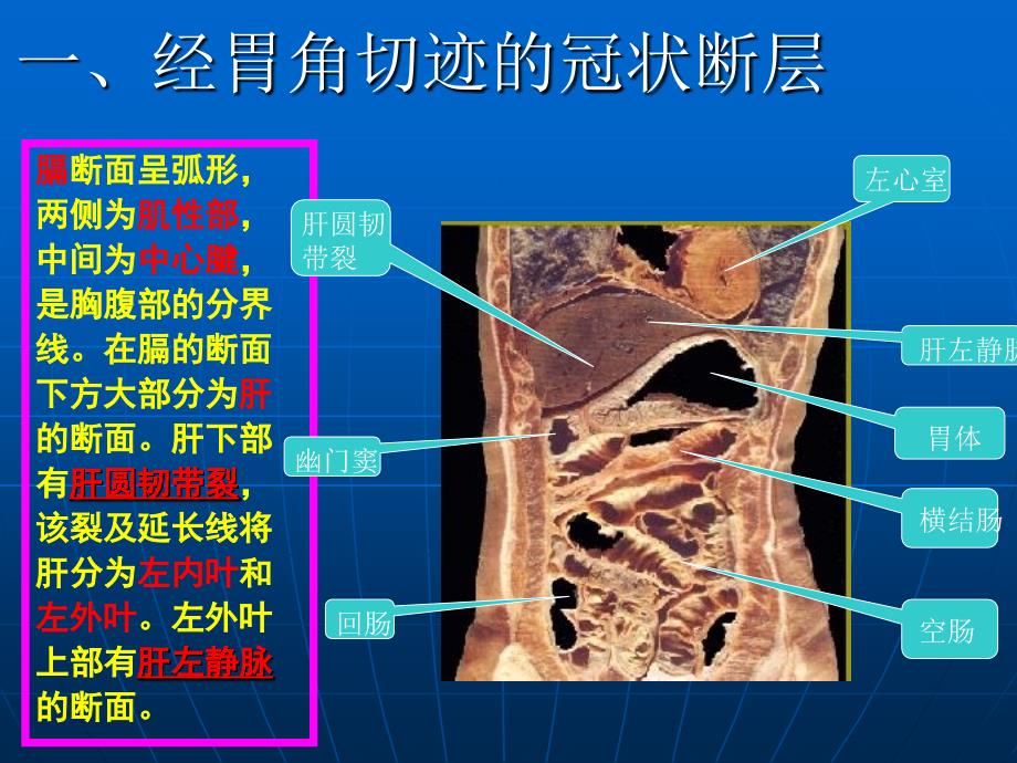 腹部断层解剖第四节腹部冠状断层解剖.ppt_第3页