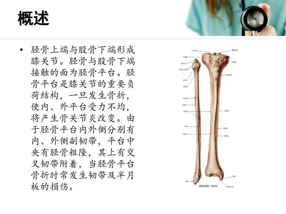 胫骨平台骨折课件.ppt_第2页