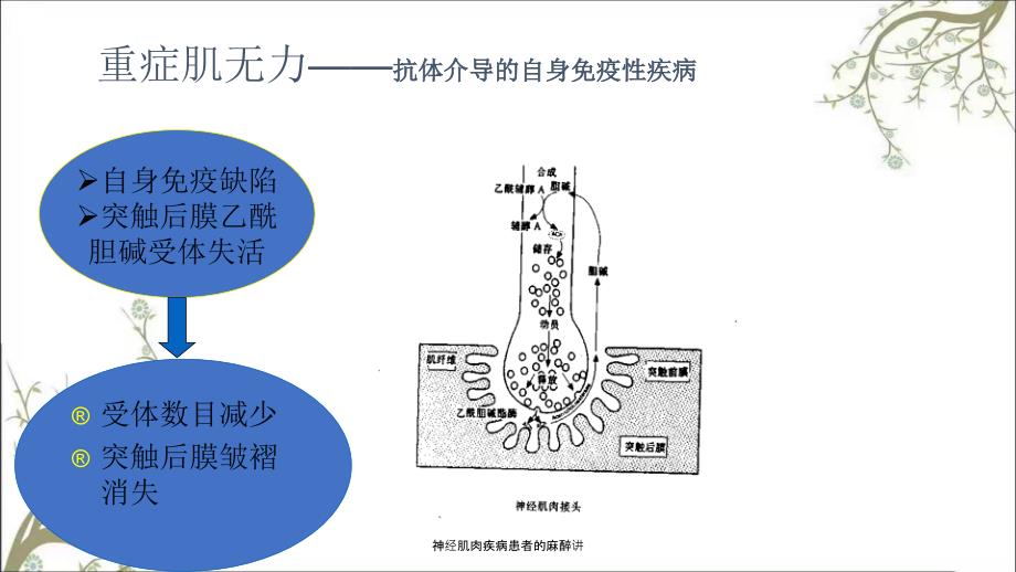 神经肌肉疾病患者的麻醉讲.ppt_第2页