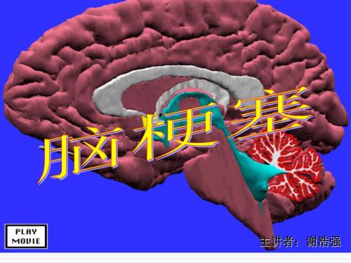 脑梗塞临床型PPT课件.ppt