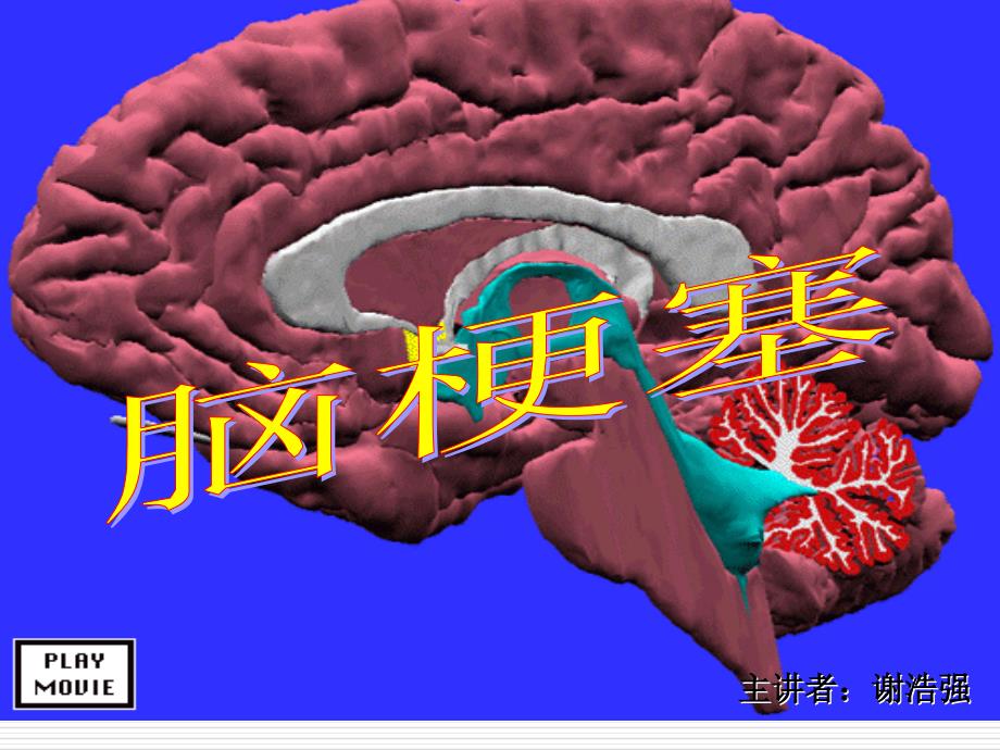 脑梗塞临床型PPT课件.ppt_第1页