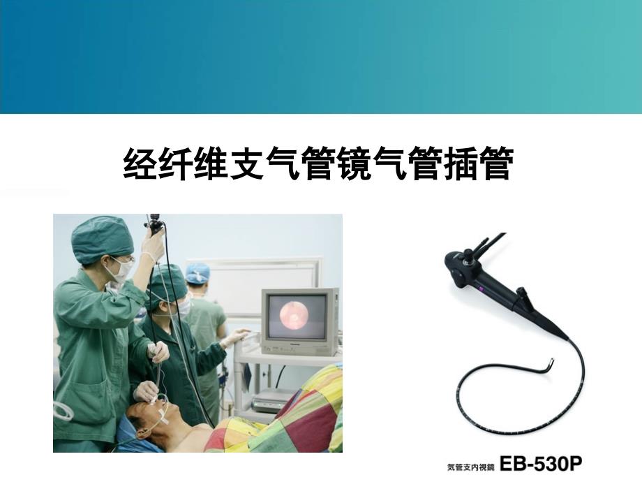 经纤维支气管镜气管插管.ppt_第1页