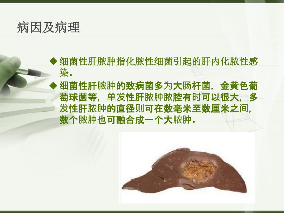 肝脓肿教学查房介绍.ppt_第2页