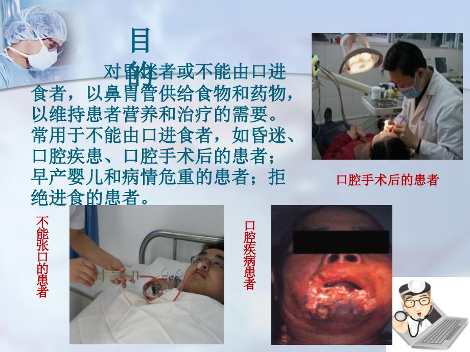 鼻饲术医学PPT.pptx_第3页
