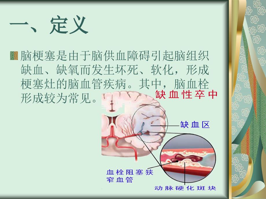 脑梗塞的护理常规PPT课件.ppt_第2页