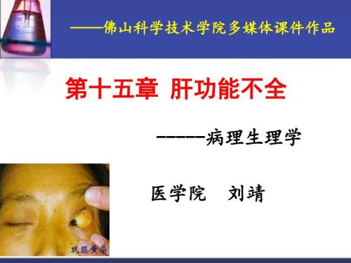 肝功能不全1.ppt