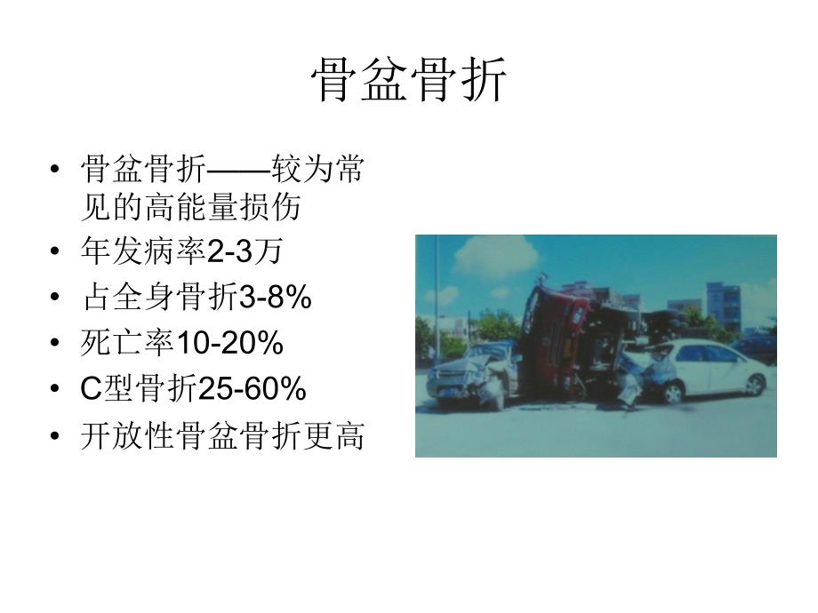 骨盆骨折的急救PPT课件.ppt_第2页