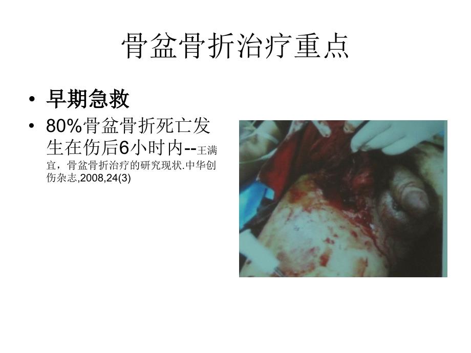 骨盆骨折的急救PPT课件.ppt_第3页
