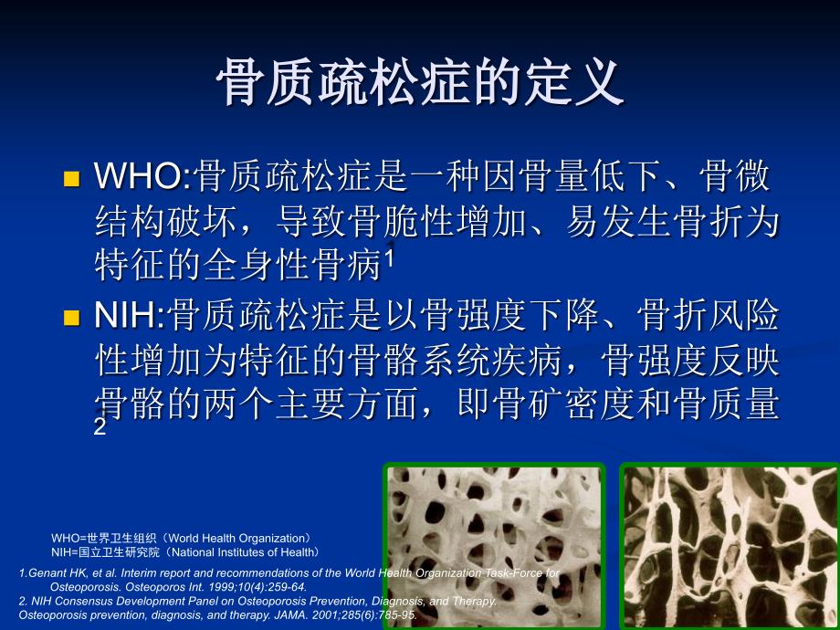 骨质疏松的危害PPT课件.ppt_第2页