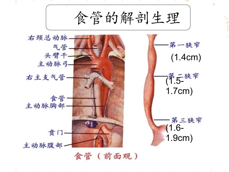 食管癌护理查房PPT课件.ppt_第3页