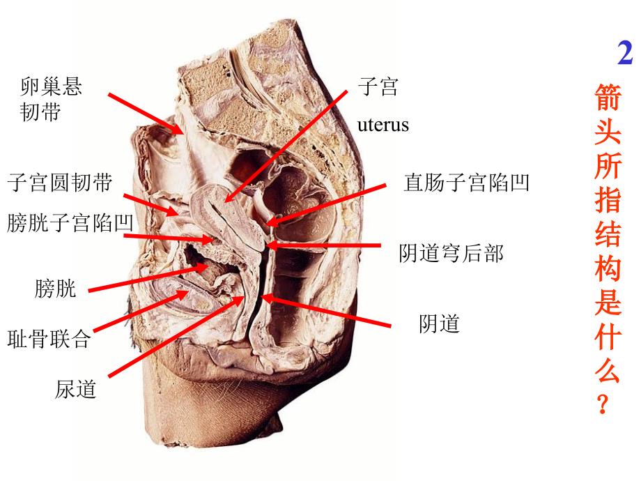 系统解剖学实验考试题全集.ppt_第2页