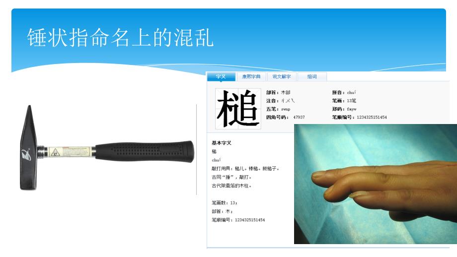 锤状指治疗进展及探索.ppt_第3页