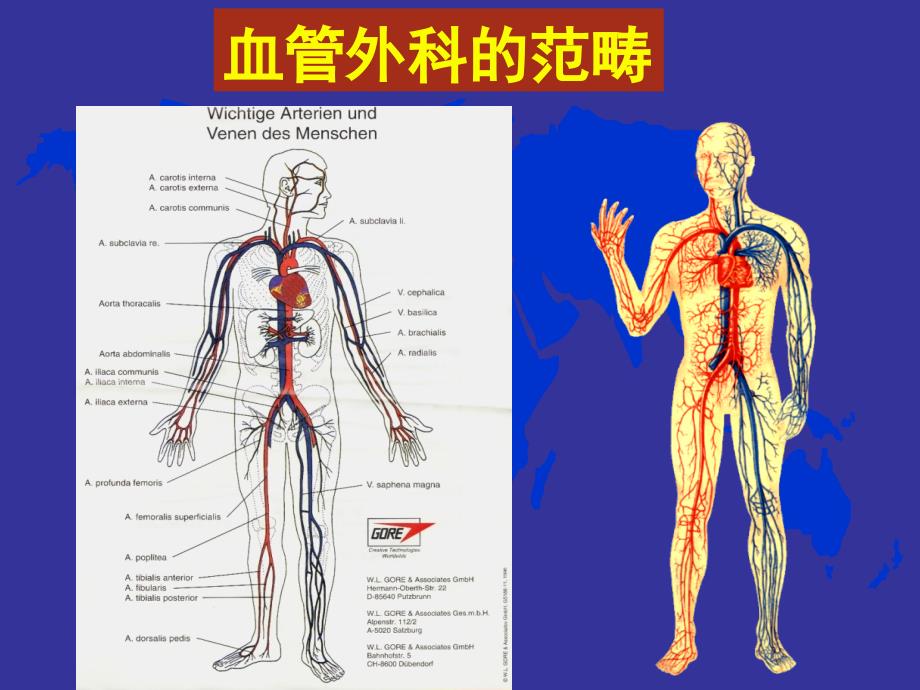 血管外科常见疾病课件.ppt_第3页